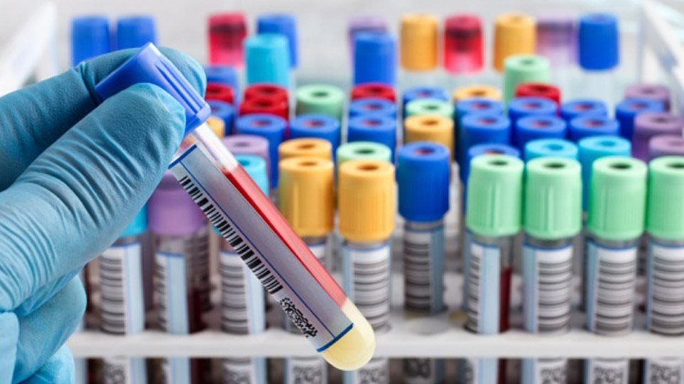 Κοροναϊός – Ο ΕΜΑ ανακοίνωσε την έναρξη αξιολόγησης του χαπιού της MSD κατά του ιού