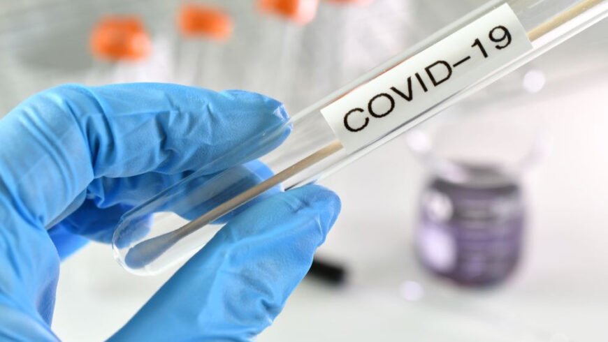 ΕΟΔΥ – Πού θα διενεργούνται δωρεάν rapid test την Πέμπτη 13 Ιανουαρίου