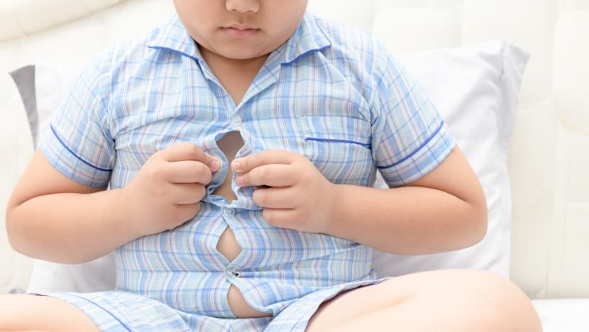 Παιδική παχυσαρκία: Μειώθηκε το προσδόκιμο ζωής για τις επόμενες γενιές